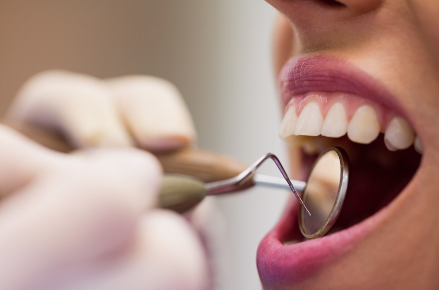 tratamientos dentales
